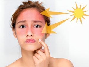 Tác động của tia cực tím dẫn đến tình trạng da mặt khô sần